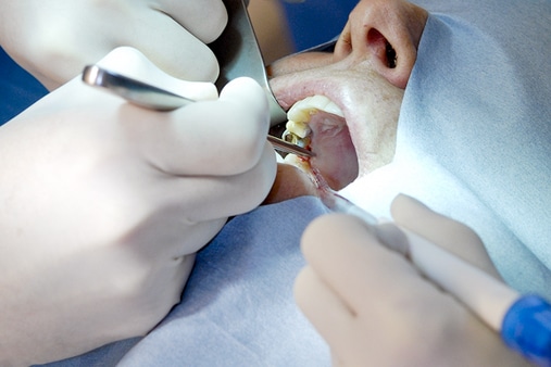 Costa Rica Dental Surgery
