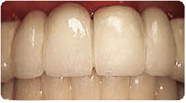 Costa Rica Dental Surgery, After