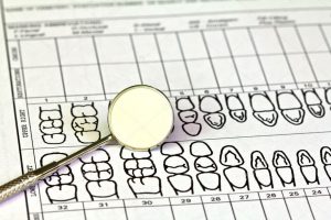 guide to tooth numberting - costa rica dental team