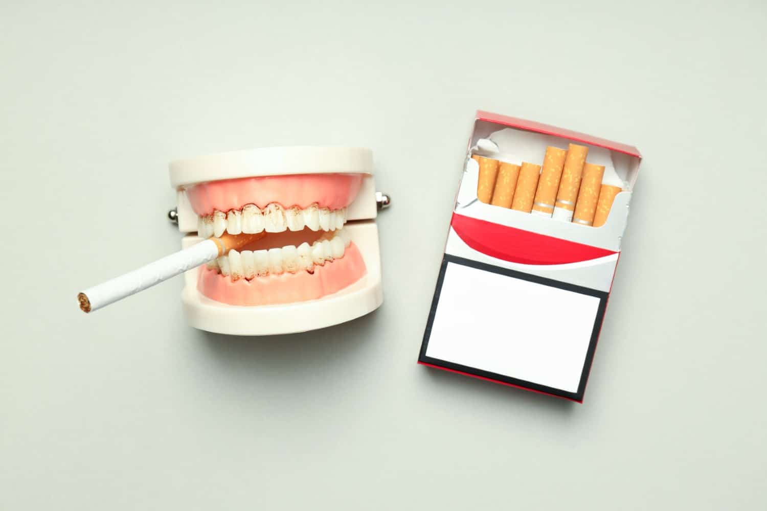 The Risks of Smoking for Teeth