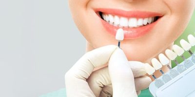 The science behind beautiful teeth